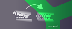 How Can Mewing Fix Overbite Mewing Coach