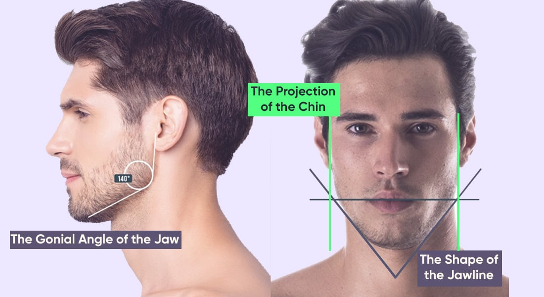 3 main jawline classification criteria: gonial angle, chin projection, shape of the jawline