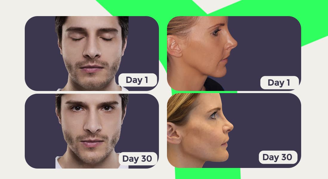 30 day challenge to lose face fat and get a jaw
