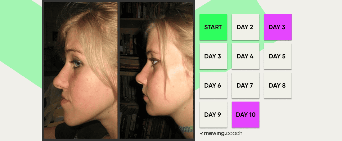 30 day mewing challenge