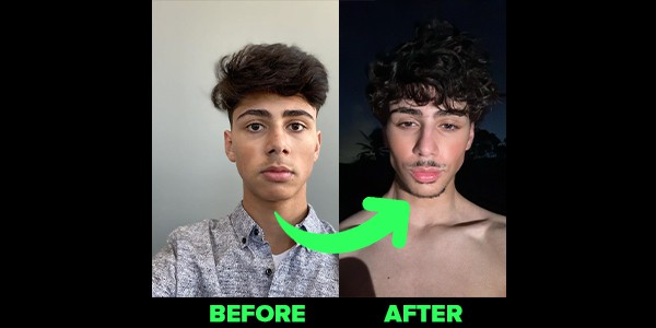 Before and after: perfect male jawline