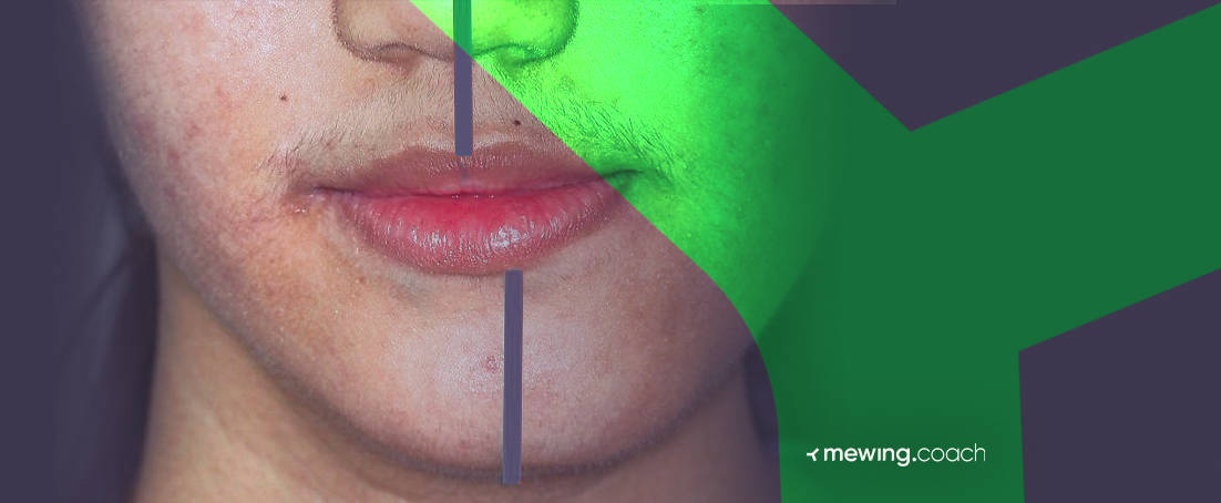 Pro Tips On How Mewing Can Help You Fix Uneven Jaw