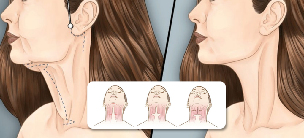 10-tips-on-how-to-get-a-wider-jaw-mewing-coach