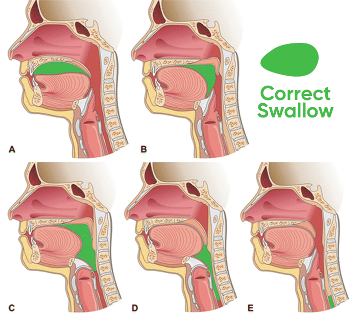 Correct swallowing when mewing diagram