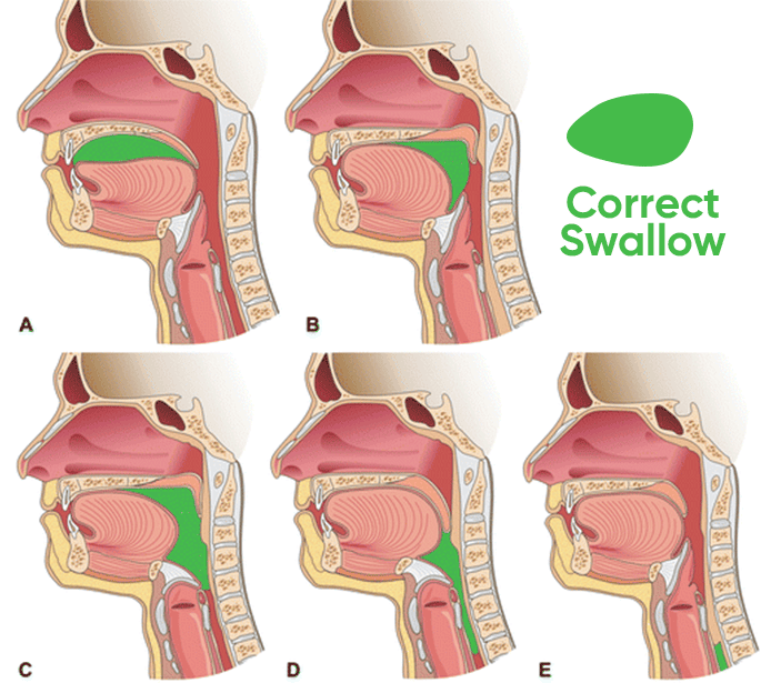 How To Swallow Correctly While Mewing Ach