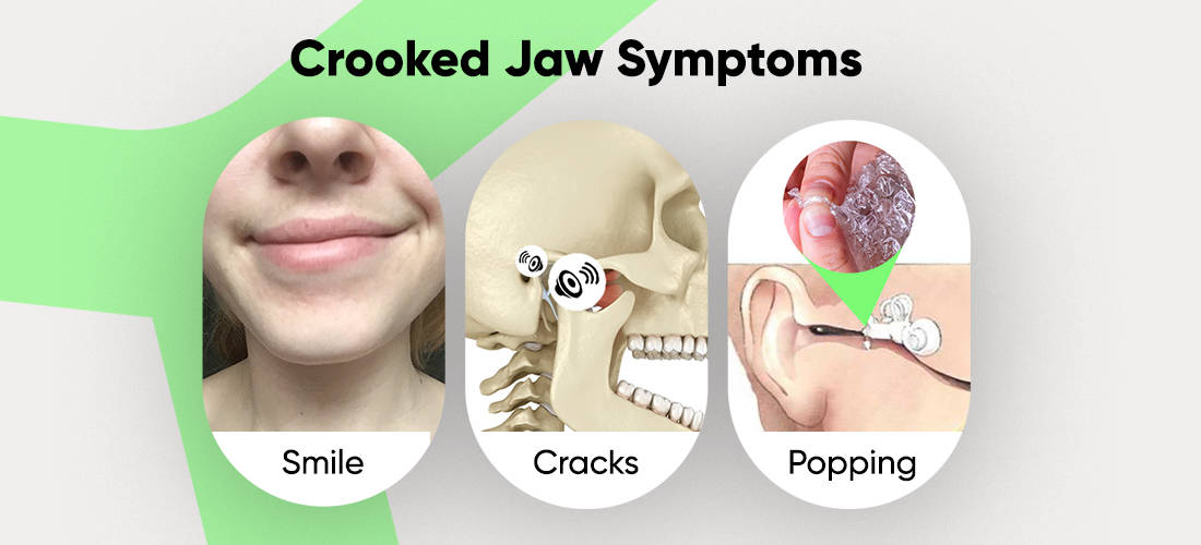 Crooked jaw symptoms: uneven smile, jaw popping, clenching, teeth grinding, tight jaw, popping in ears