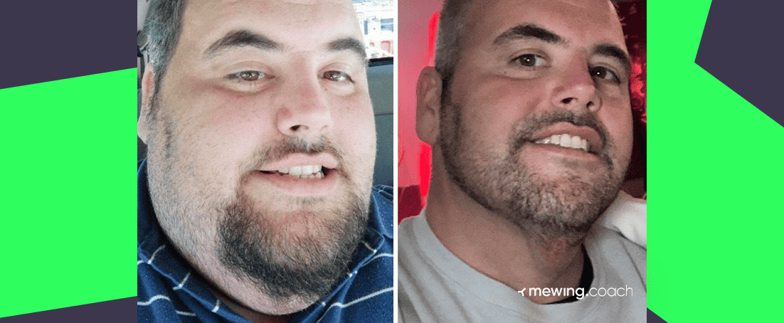 How to lose chin online and neck fat fast