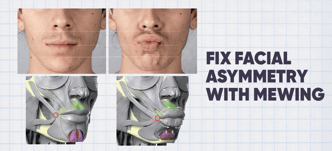 Fix facial asymmetry with mewing