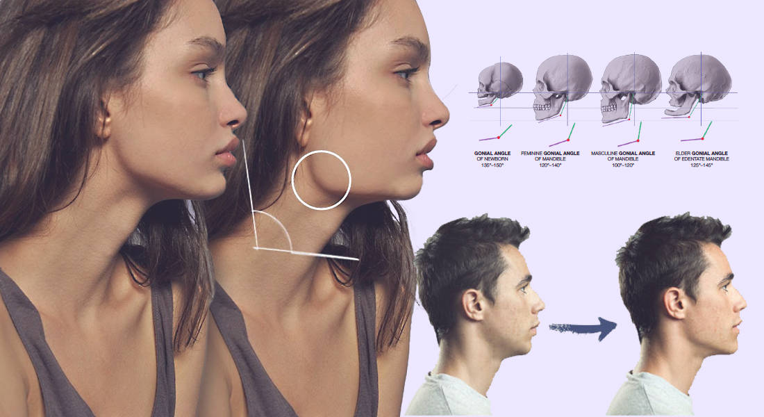 Mewing Exercises. Result of a Jawline Reshape Stock Photo - Image