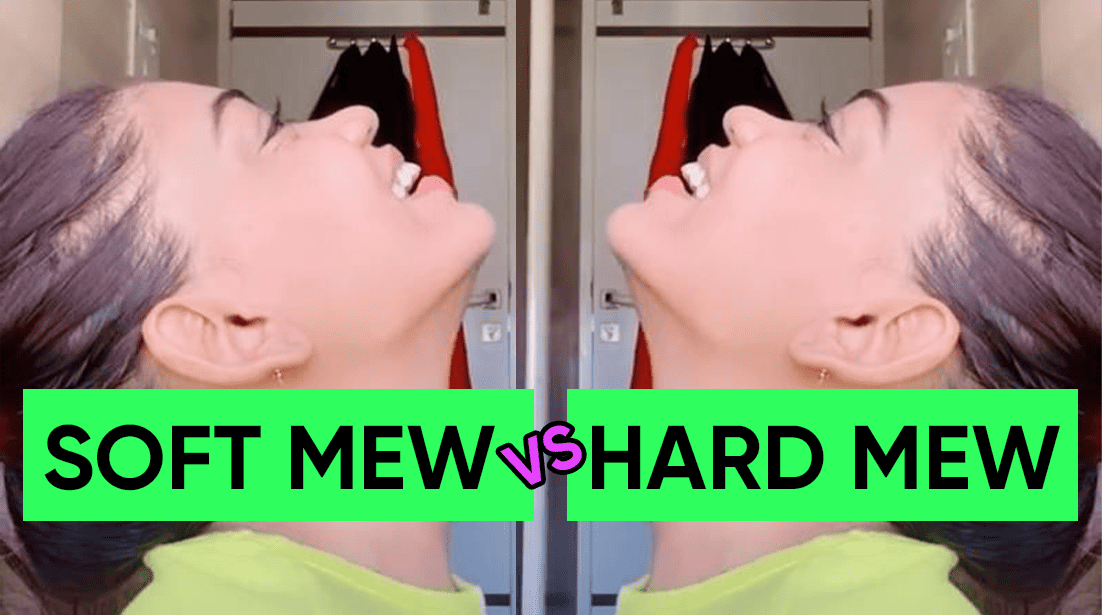 Hard mewing vs soft mewing