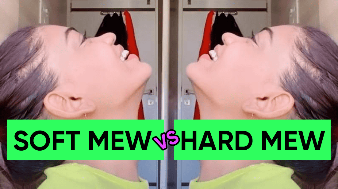 What Is Hard Mewing and How to Make Sure You're Ready for It