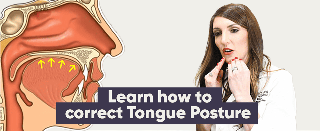 Learn how to correct tongue posture