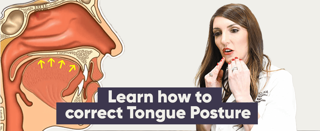 Open Mouth Posture: Causes & How to Fix It