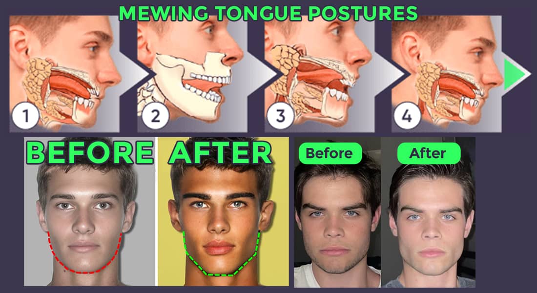 Mewing helps to lose face fat and get a jawline