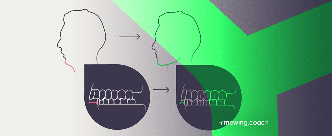 Mewing Teeth Position: The Right Way To Do it! | Mewing.coach