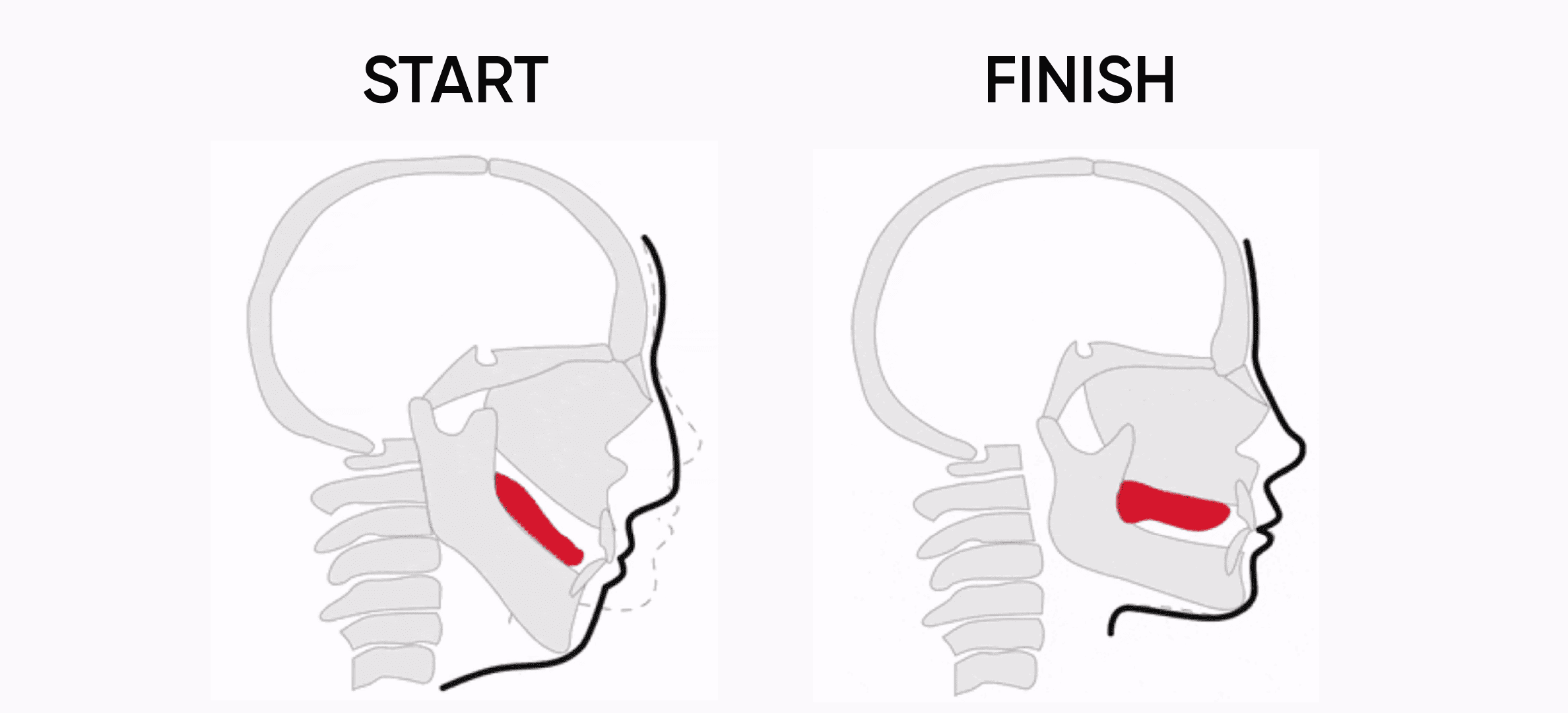 Mewing  Keep Correct Tongue Posture – Koko Face Yoga