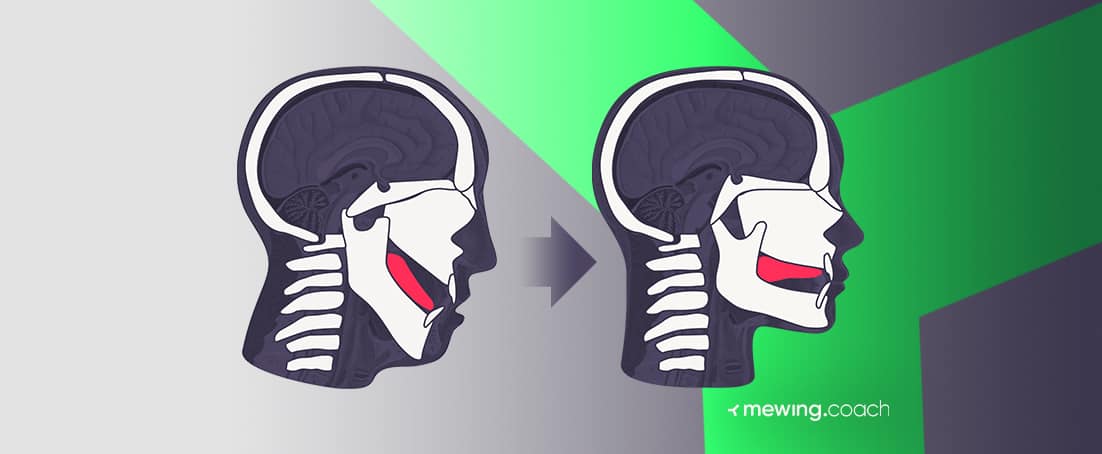 Mewing and Orthotropics: How to Change Your Facial Bone Structure