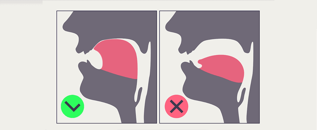 Proper mewing tongue posture diagram