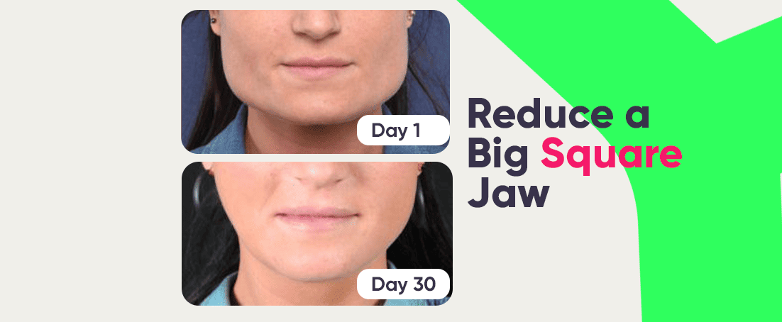 Square jaw before and after transformation