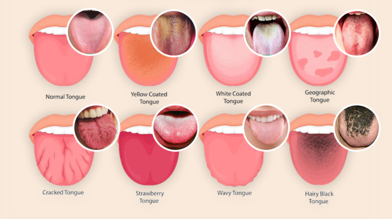 How to Swallow Correctly While Mewing | Mewing.coach