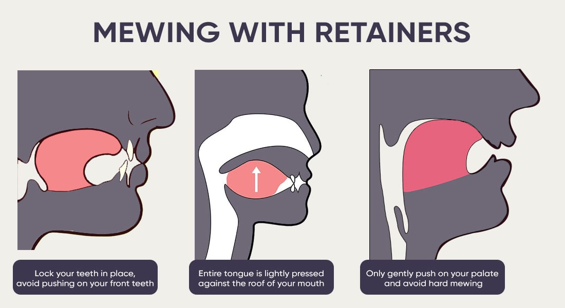 Tutorial on how to mew with retainers