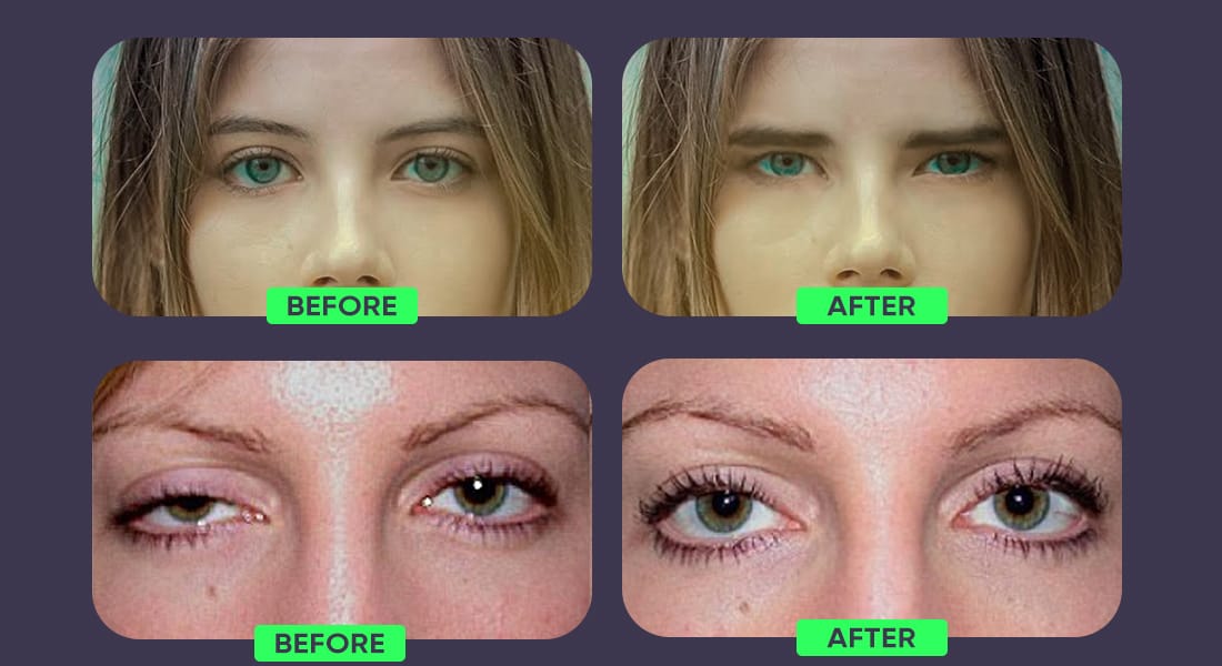 Woman eyes before and after mewing