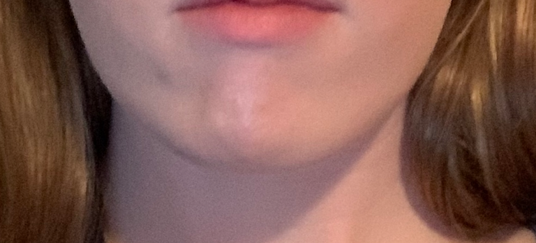 10 Different Types & Shapes of Chin: A Comprehensive List | Mewing.coach