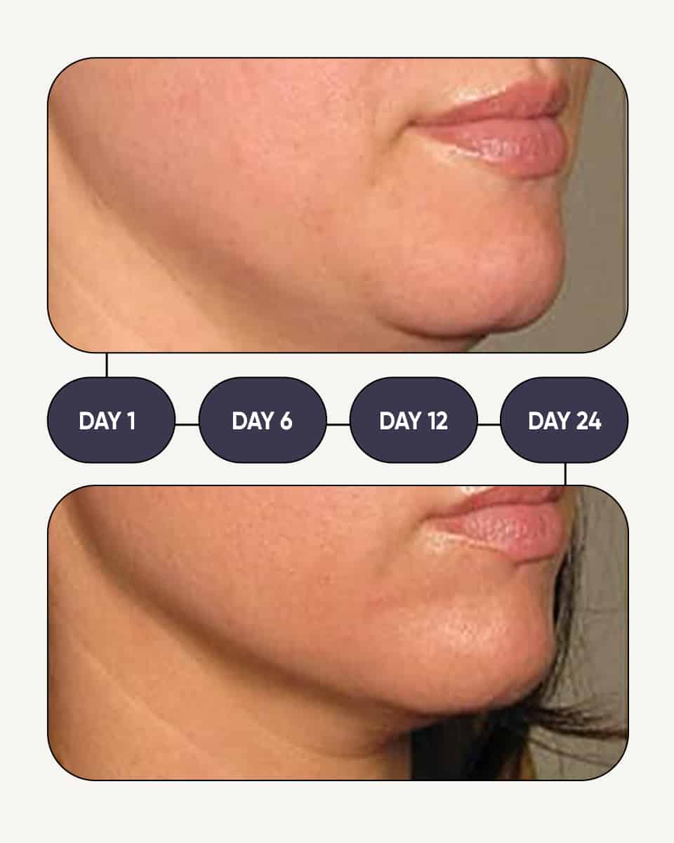 Face yoga double chin results female