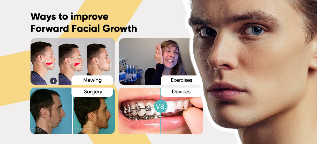 Four ways to improve forward facial growth