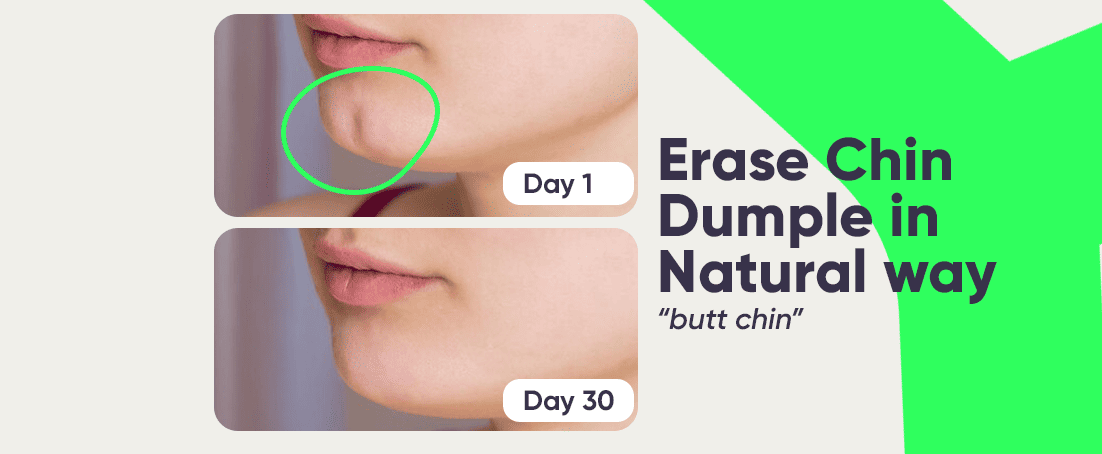 How to get rid of a cleft chin