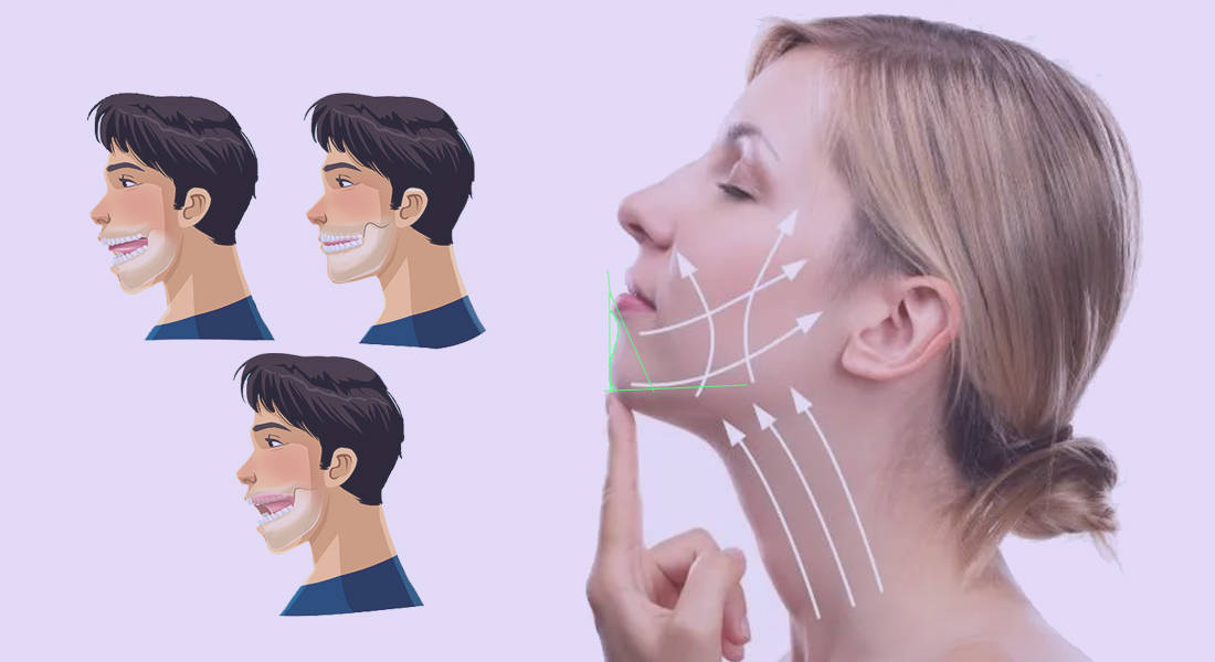 How to get rid of a pointy chin