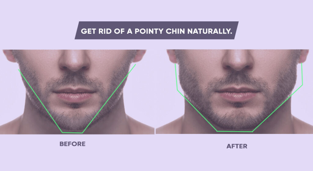 How To Get Rid Of A Pointy Chin If It s Too Visible To Your Liking 