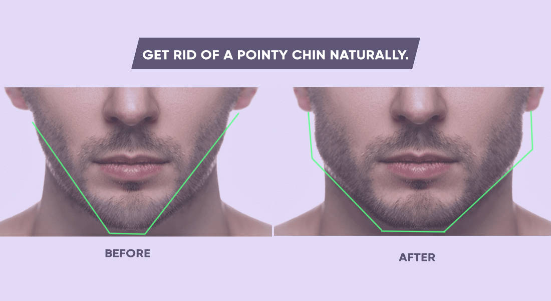 Pointy chin transformation after face exercises