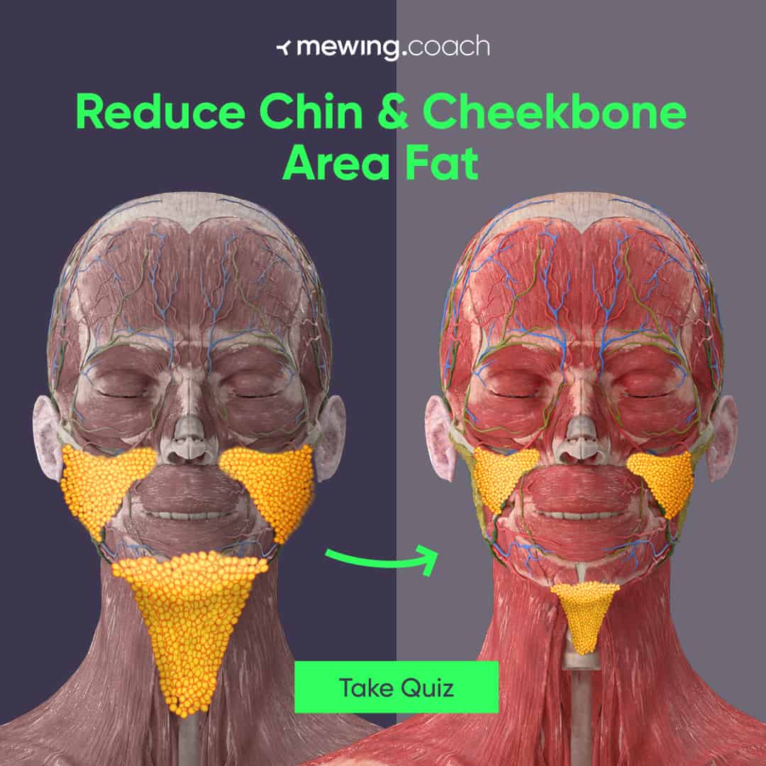 example on how to reduce chin and cheekbone area fat