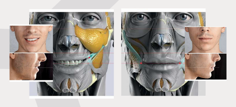 How to tighten skin under chin