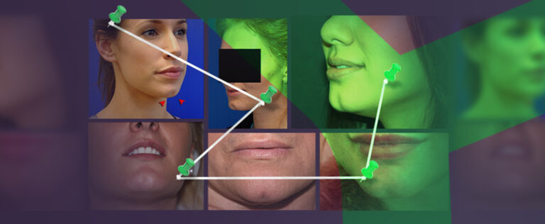 What Causes a Cleft Chin According to Science | Mewing.coach