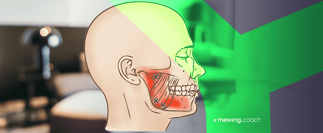 Mewing  Teeth clenching, Facial muscles, Myofunctional therapy