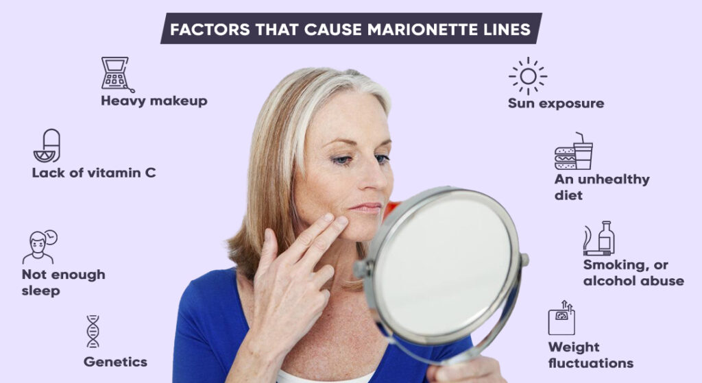 How to Get Rid of Lines Naturally and What Causes Them