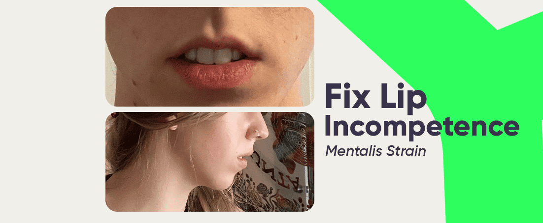 How to fix lip incompetence