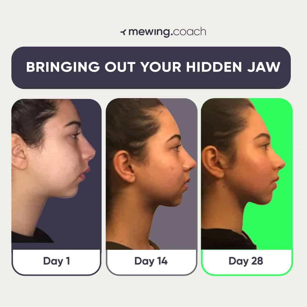 Woman transformation from weak jawline to strong jaw in 28 days