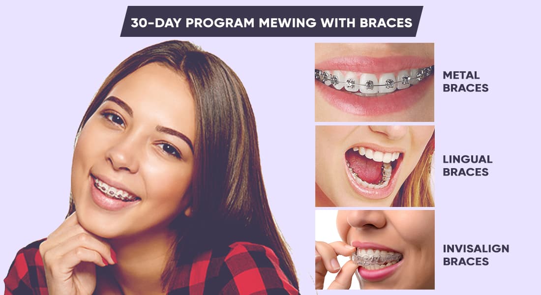 Mewing works with different types of braces, including: metal braces, lingual braces and invisalign braces