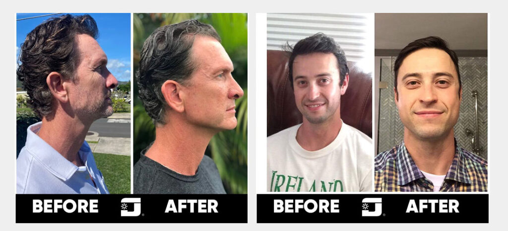 Jawzrsize Review: In-Depth Evaluation of Facial Fitness Tools | Mewing