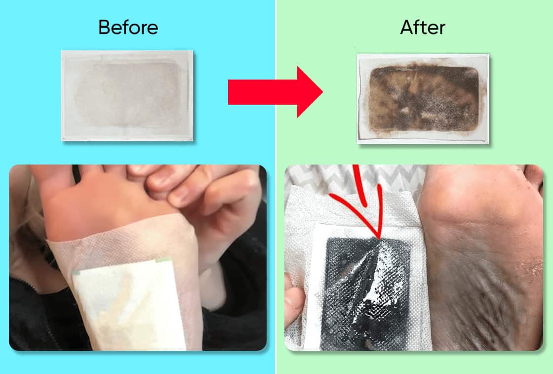 Detox food pads turned black before and after using