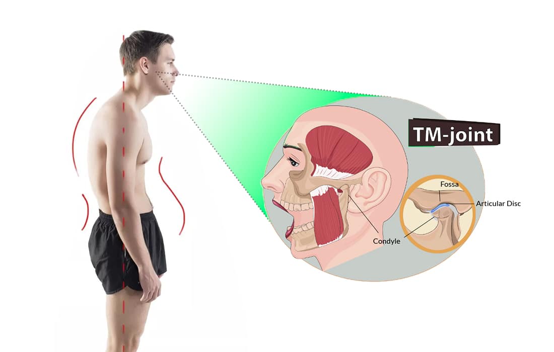 Diagram of how mewing help with TMJ