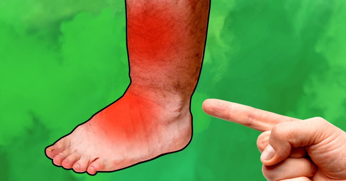 Foot pain relief after wearing heels