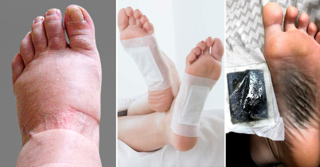 what-causes-swollen-feet