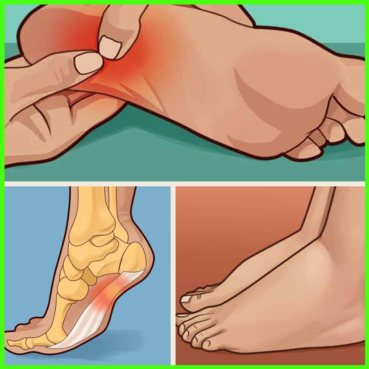 How to Massage a Swollen Foot