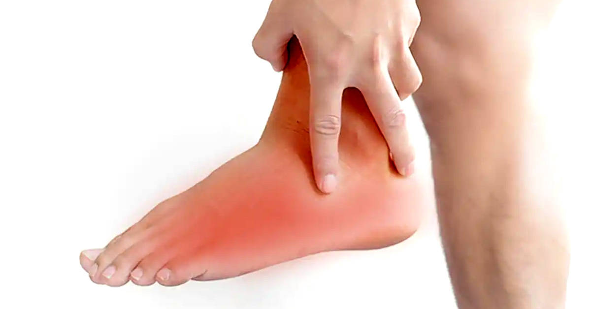 Swollen ankle duration
