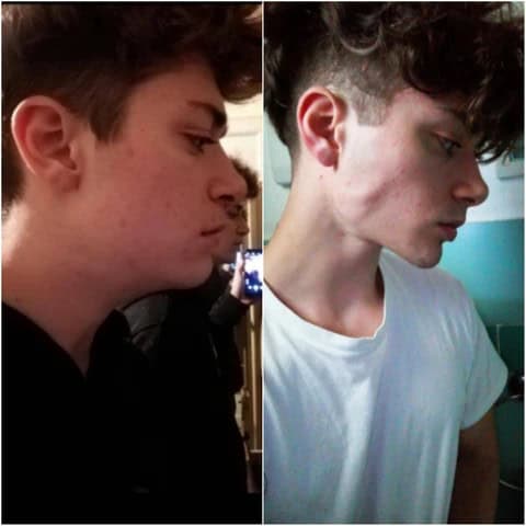 Before and after thumb pulling transformation young man