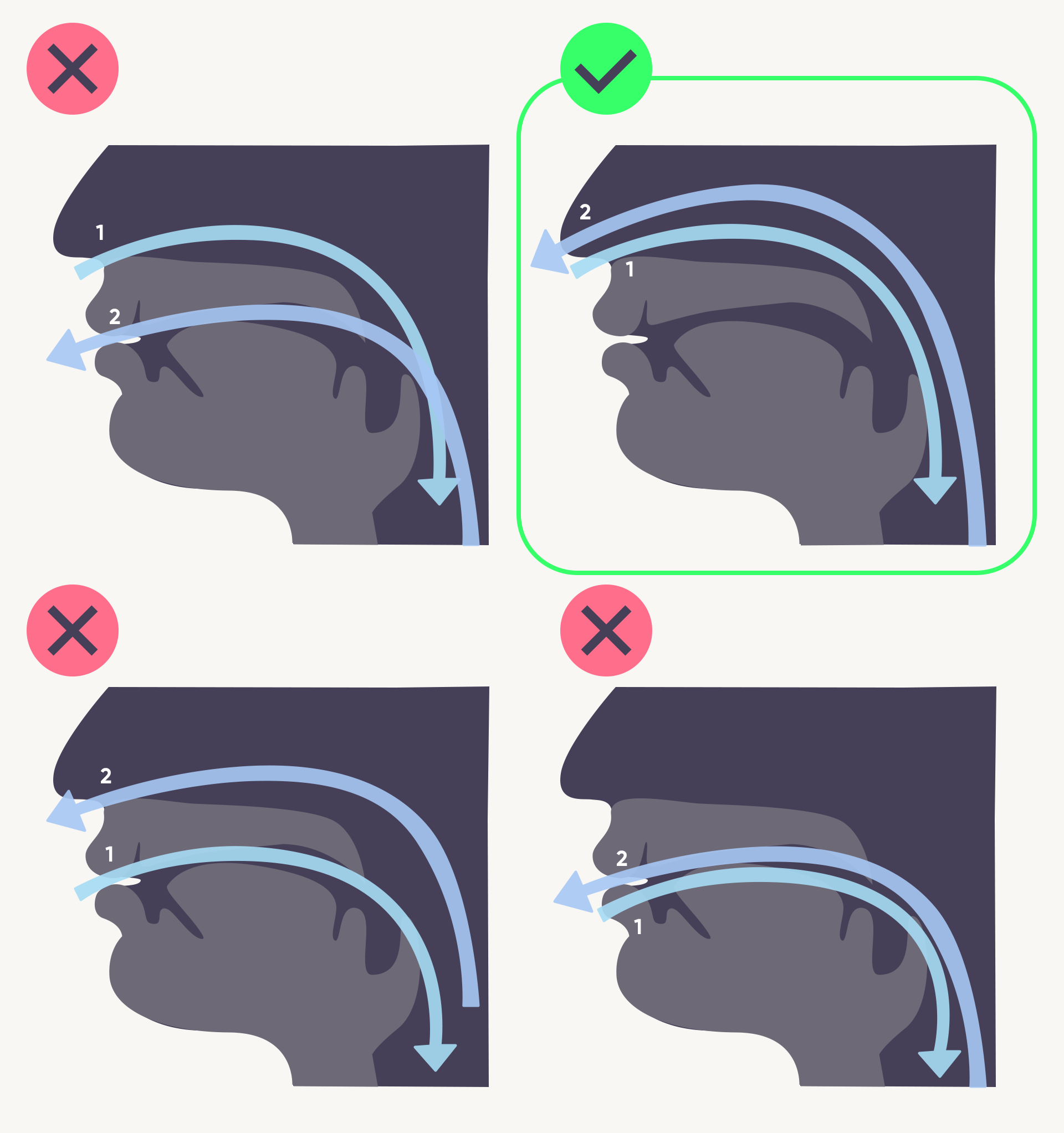 These tongue exercises called 'mewing' are so effective I don't do filler  anymore